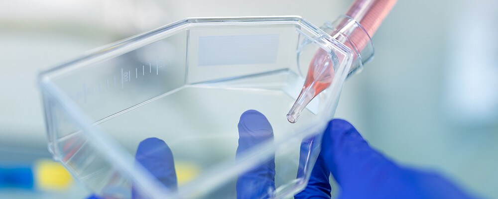 Ein/e Forscher:in hält eine Petrischale und eine Pipette in den Händen