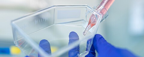 Ein/e Forscher:in hält eine Petrischale und eine Pipette in den Händen